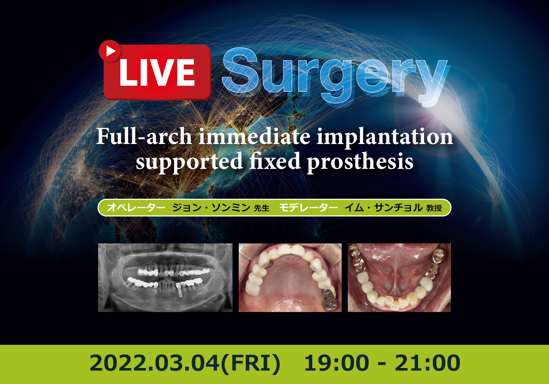 Live Surgery (2022.03.04)