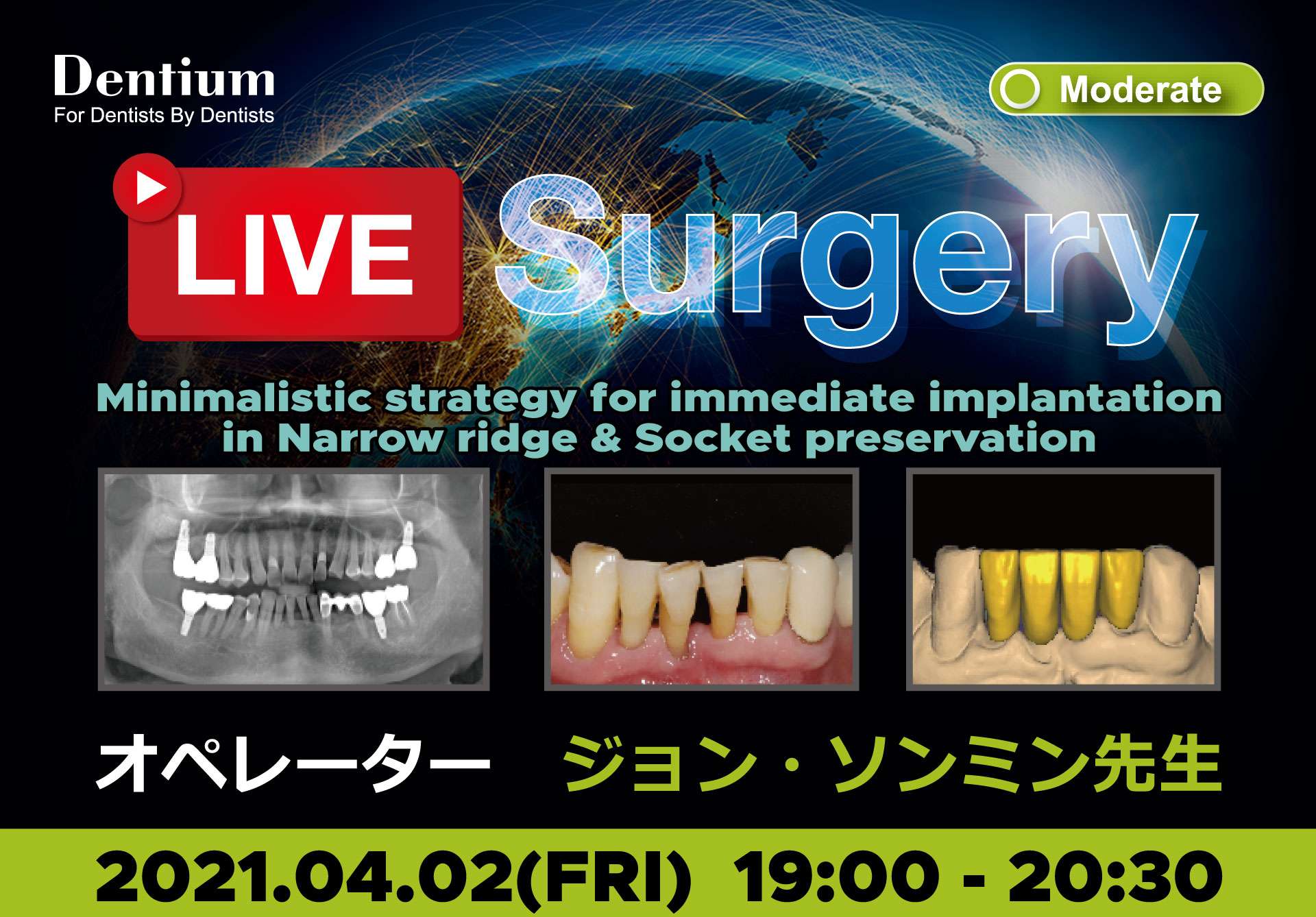 Live Surgery (2021.04.02)