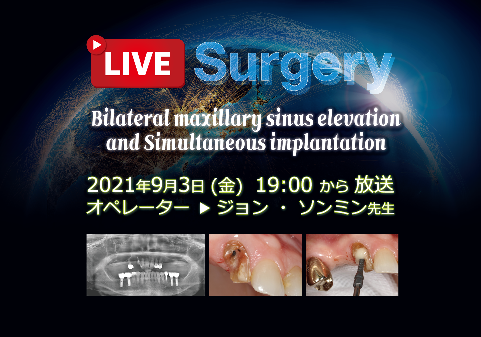 Live Surgery (2021.09.03)