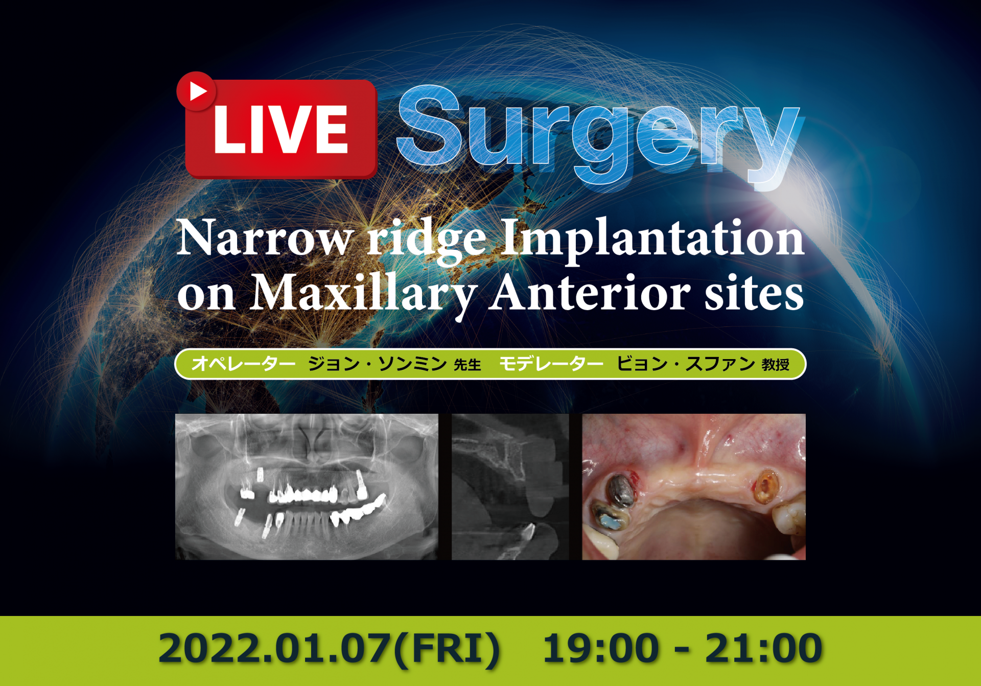Live Surgery (2022.01.07)