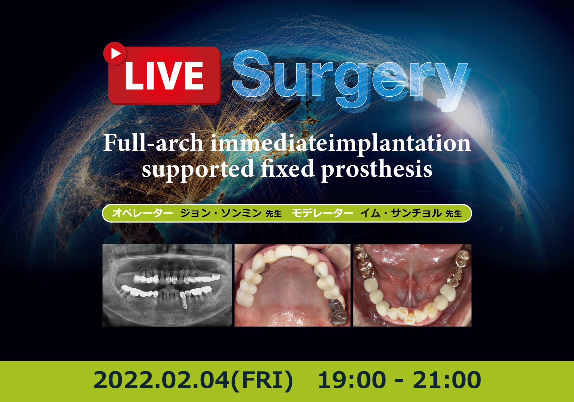 Live Surgery (2022.02.04)