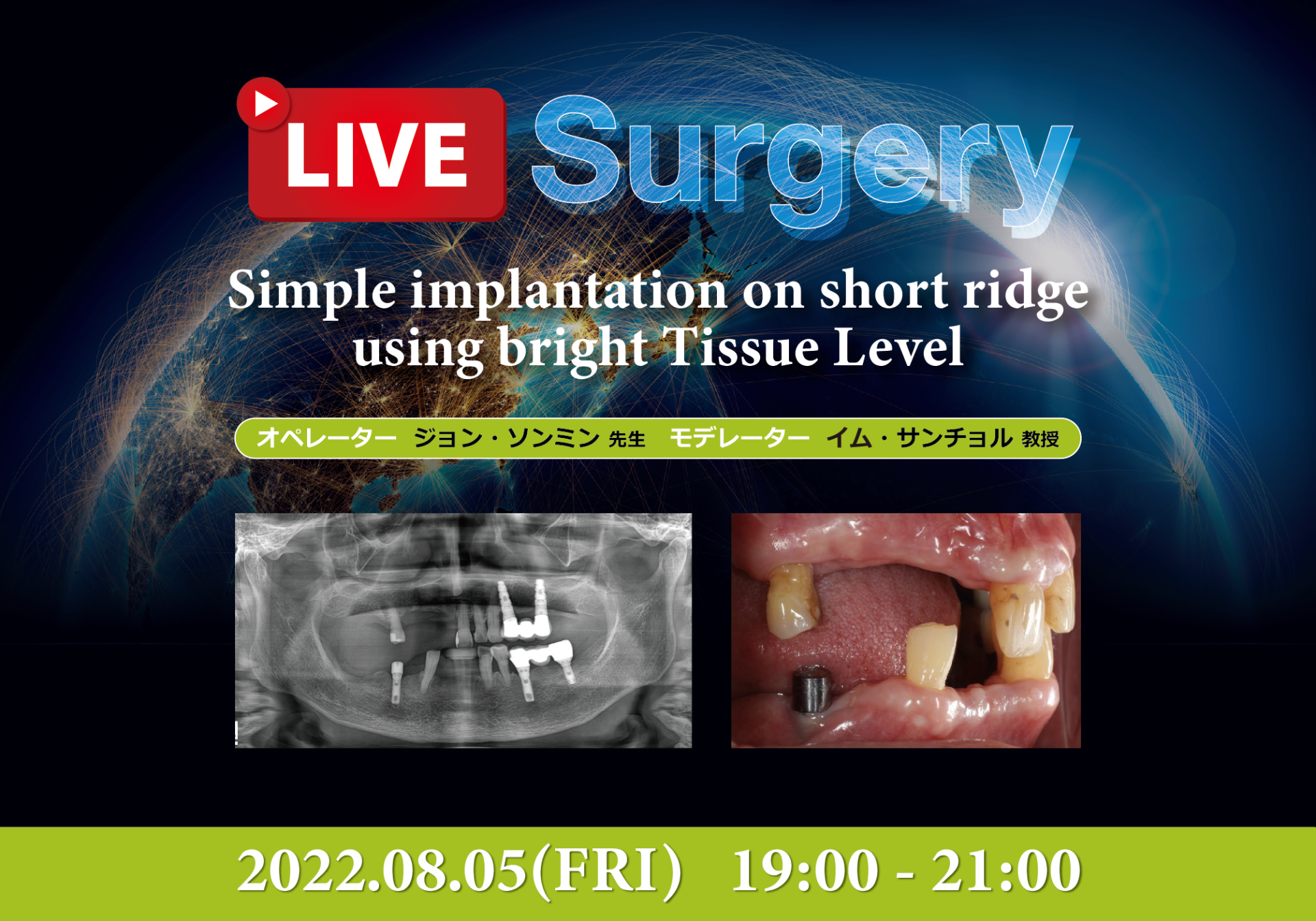Live Surgery (2022.08.05)